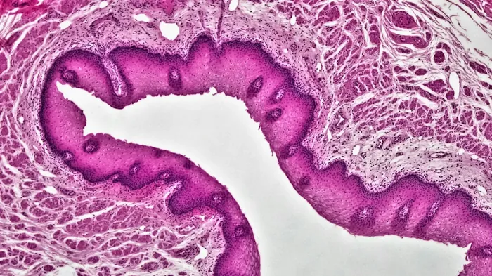 Biopsy tissue (illustrative image)